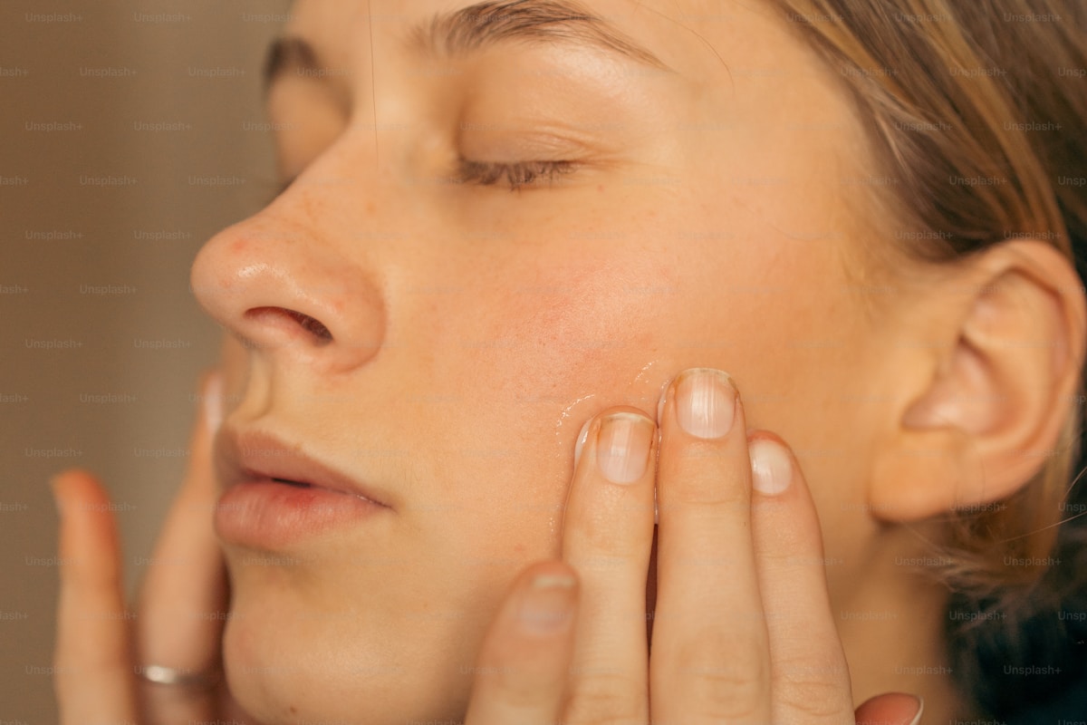 Clear skin results after acne treatment